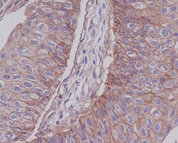 Anti-Integrin beta 1 ITGB1 Rabbit Monoclonal Antibody