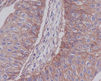 Integrin beta 1 ITGB1 Rabbit Monoclonal Antibody