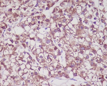 Anti-MMP3 Rabbit Monoclonal Antibody