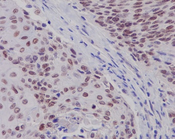 Estrogen Receptor beta ESR2 Rabbit Monoclonal Antibody