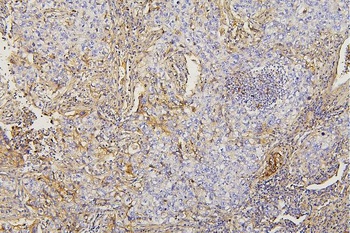 Collagen III/COL3A1 Antibody (monoclonal, 9H9)