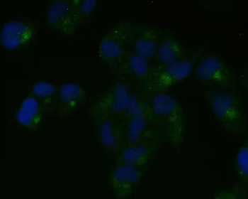 Nestin Rabbit Monoclonal Antibody
