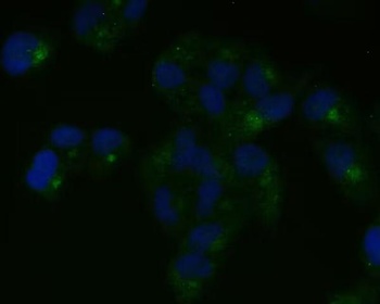 Anti-Nestin Rabbit Monoclonal Antibody
