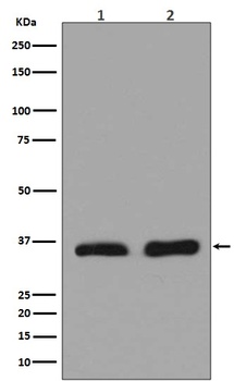 Lactate Dehydrogenase LDHA Rabbit Monoclonal Antibody