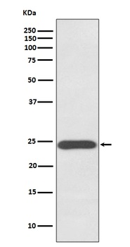 Anti-Growth Hormone GH1 Rabbit Monoclonal Antibody