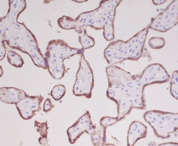 Growth Hormone GH1 Rabbit Monoclonal Antibody
