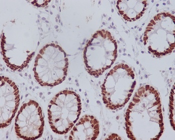 CDX2 Rabbit Monoclonal Antibody