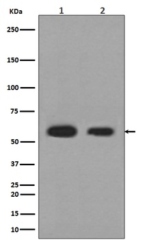 Calreticulin Rabbit Monoclonal Antibody