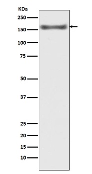 Anti-ASK1 MAP3K5 Rabbit Monoclonal Antibody