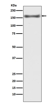 ASK1 MAP3K5 Rabbit Monoclonal Antibody