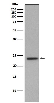 Id1 Rabbit Monoclonal Antibody