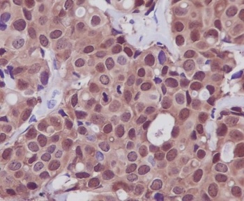 Hsp70 HSPA1A Rabbit Monoclonal Antibody
