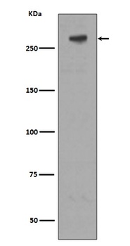 Anti-M6PR IGF2R Rabbit Monoclonal Antibody