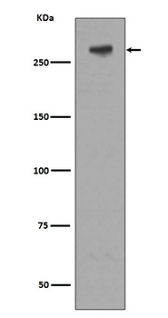 M6PR IGF2R Rabbit Monoclonal Antibody