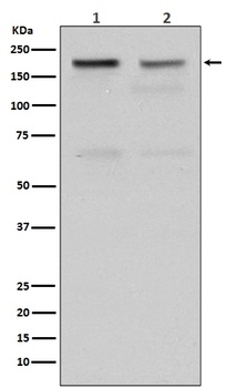 Topoisomerase II alpha TOP2A Rabbit Monoclonal Antibody
