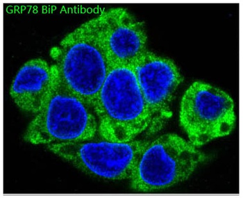 GRP78 BiP HSPA5 Rabbit Monoclonal Antibody