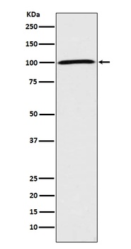 Sodium Potassium ATPase ATP1A1 Rabbit Monoclonal Antibody