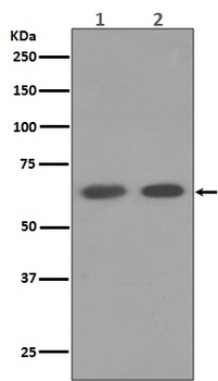 AMPK alpha 1 PRKAA1 Rabbit Monoclonal Antibody