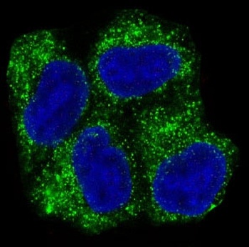 AMPK alpha 1 PRKAA1 Rabbit Monoclonal Antibody