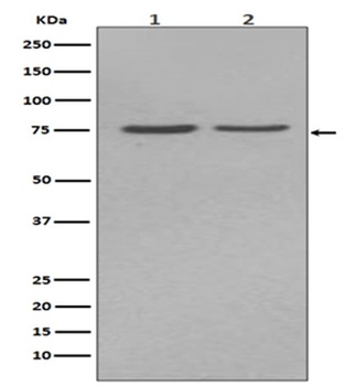 Alkaline Phosphatase ALPL Rabbit Monoclonal Antibody