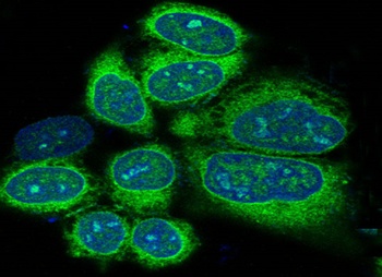 Anti-Alkaline Phosphatase ALPL Rabbit Monoclonal Antibody