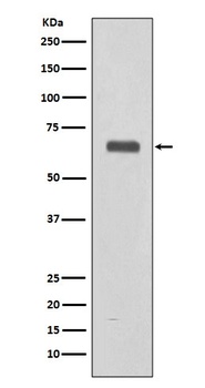 C9/Complement Component C9 Rabbit Monoclonal Antibody