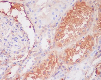 C9/Complement Component C9 Rabbit Monoclonal Antibody