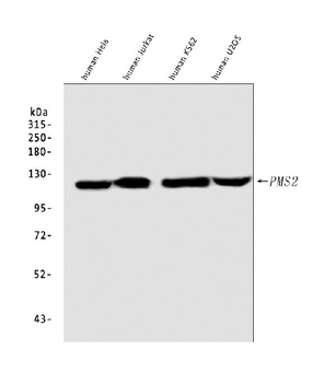 Anti-PMS2 Rabbit Monoclonal Antibody