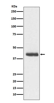 DCX/Doublecortin Rabbit Monoclonal Antibody