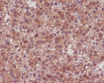 Anti-Hsp90 alpha + beta HSP90AA1 Rabbit Monoclonal Antibody