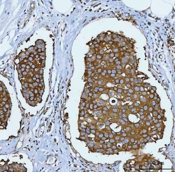 Anti-Hsp90 alpha + beta HSP90AA1 Rabbit Monoclonal Antibody