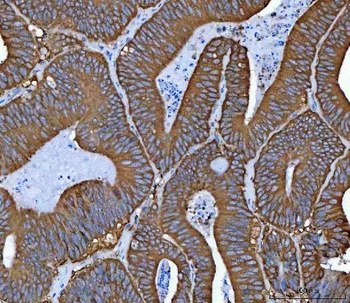 Anti-Hsp90 alpha + beta HSP90AA1 Rabbit Monoclonal Antibody
