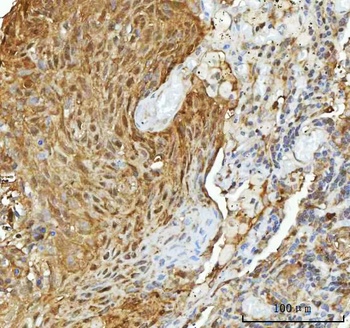Anti-Hsp90 alpha + beta HSP90AA1 Rabbit Monoclonal Antibody