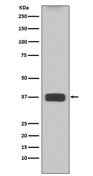 ARG1/Arginase 1 Rabbit Monoclonal Antibody