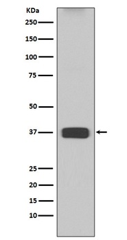 Anti-ARG1/Arginase 1 Rabbit Monoclonal Antibody