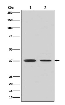 Liver Arginase ARG1 Rabbit Monoclonal Antibody