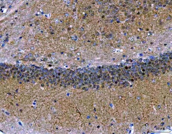 Anti-MEF2A+MEF2C Rabbit Monoclonal Antibody