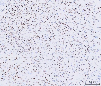 Anti-MEF2A+MEF2C Rabbit Monoclonal Antibody