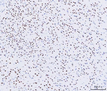 MEF2A+MEF2C Rabbit Monoclonal Antibody