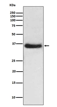 Anti-IKB alpha NFKBIA Rabbit Monoclonal Antibody
