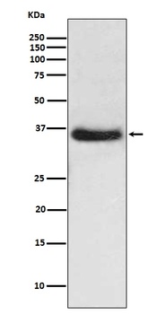 IKB alpha NFKBIA Rabbit Monoclonal Antibody