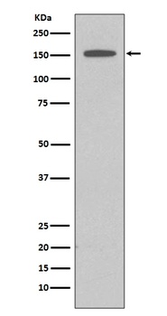 DAP Kinase 1 DAPK1 Rabbit Monoclonal Antibody