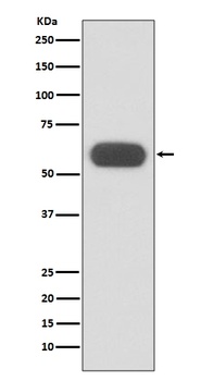 GBA/Glucosylceramidase Rabbit Monoclonal Antibody