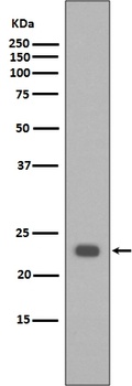 Bak BAK1 Rabbit Monoclonal Antibody