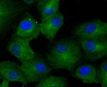 Anti-GCN2 EIF2AK4 Rabbit Monoclonal Antibody