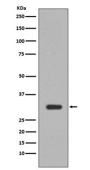 PIM1 Rabbit Monoclonal Antibody