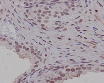 PIM1 Rabbit Monoclonal Antibody