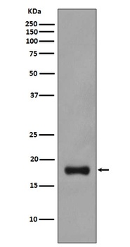 Stathmin 1 STMN1 Rabbit Monoclonal Antibody