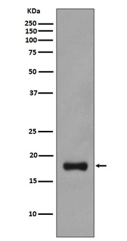 Anti-Stathmin 1 STMN1 Rabbit Monoclonal Antibody
