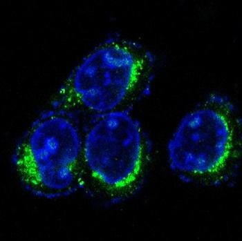 CD9 Rabbit Monoclonal Antibody